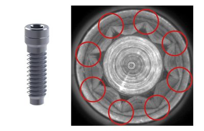 使用 HCN 镜头对微型牙科种植螺钉进行特征数量检测